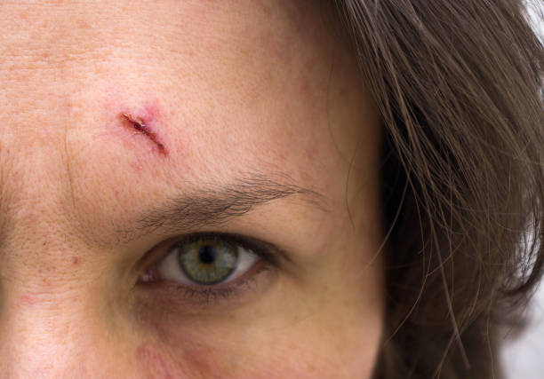 Meaning of Dreaming About Being Cut in the Face