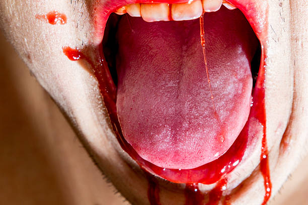 Meaning Of Dreaming About Spitting Blood From The Mouth
